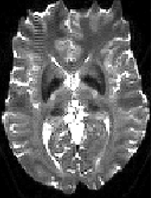 MRI Contrast RMT 1 Diagram