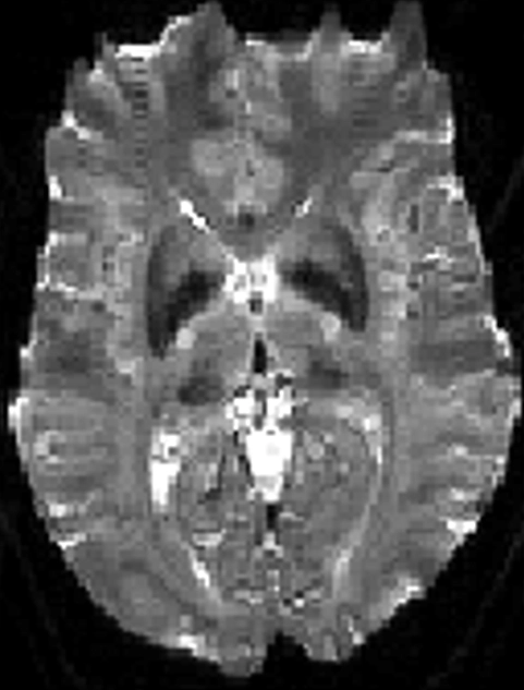 MRI Contrast RMT 2 Diagram