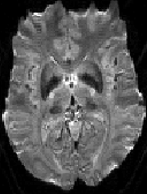 MRI Contrast RMT 3 Diagram