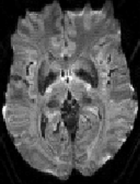 MRI Contrast RMT 4 Diagram