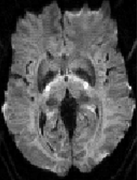 MRI Contrast RMT 5 Diagram