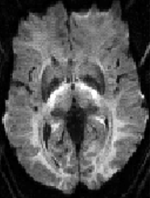 MRI Contrast RMT 6 Diagram