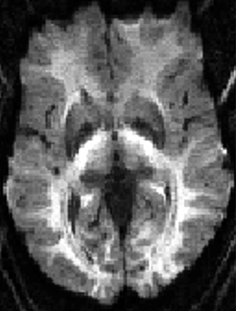 MRI Contrast RMT 7 Diagram