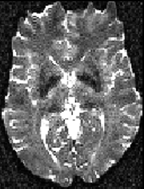 MRI Contrast Original 1 Diagram