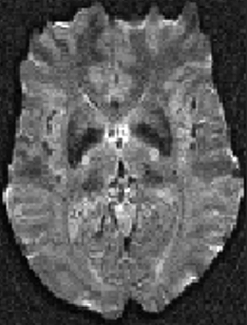 MRI Contrast Original 3 Diagram