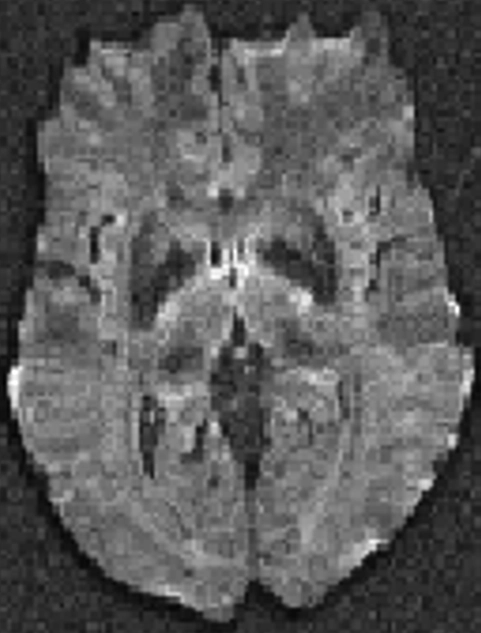 MRI Contrast Original 4 Diagram