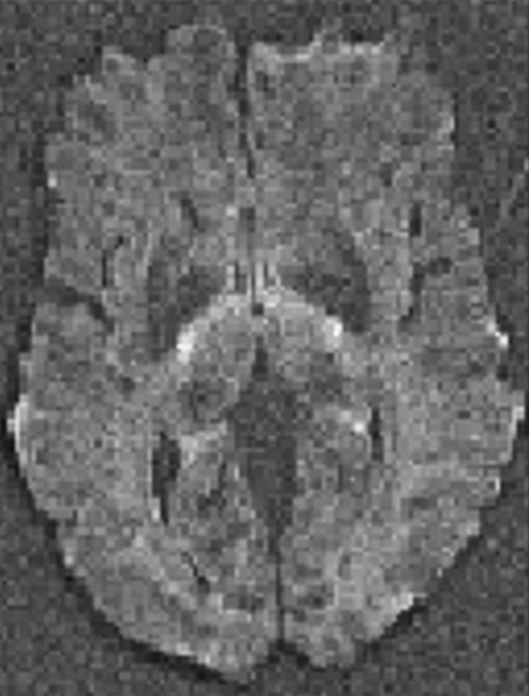 MRI Contrast Original 5 Diagram