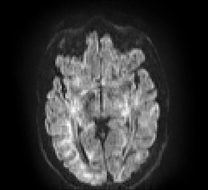 MRI Quality Set 2 MICSI