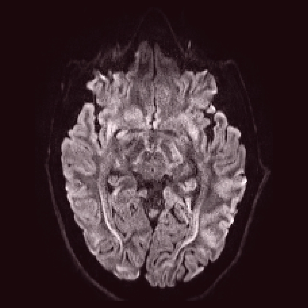 Brain Scan RMT